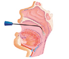 耳鼻科的咽喉手術画像
